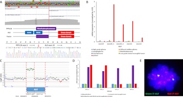 Genomic Characterization of a PPP1CB-ALK Fusion.jpg
