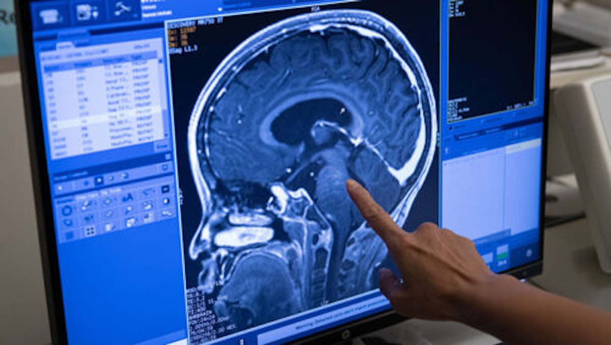 Past, present and future of Focused Ultrasound as an adjunct or